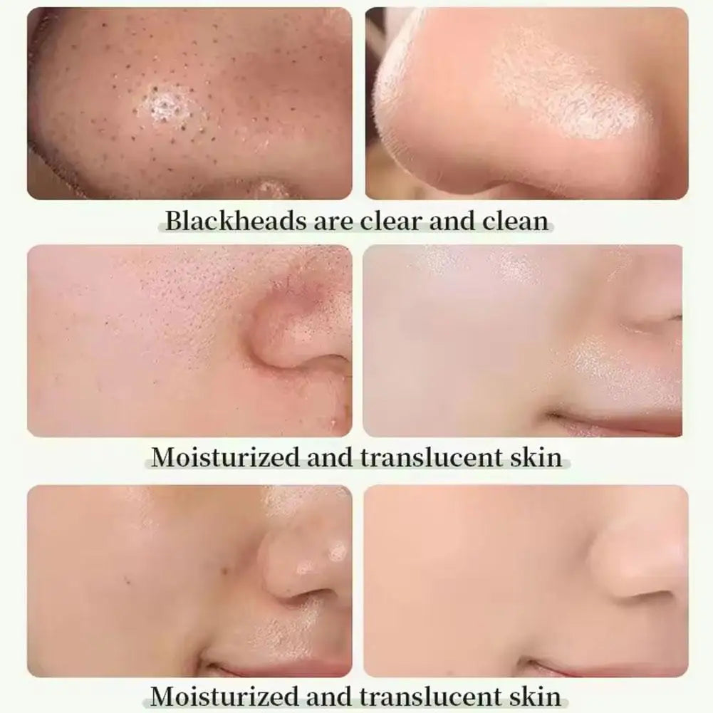Barra de arcilla de té verde para la cara, máscara verde, palo para frotar el acné, encogimiento, espinillas, extracto de té verde, máscara Facial, limpieza de poros